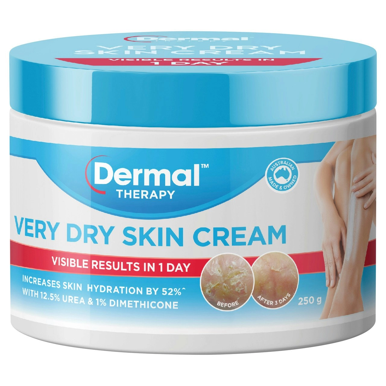 Dermal Therapy Very Dry Skin Cream 250g